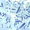 Legionella_pneumophila Foto: AdobeStock rgpilch